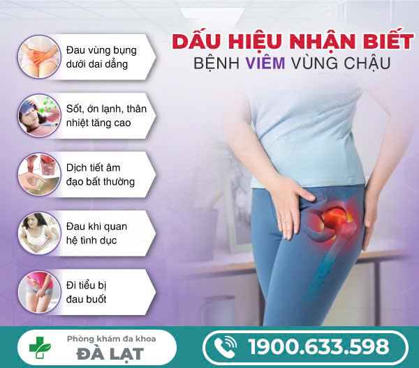 Hình ảnh minh họa